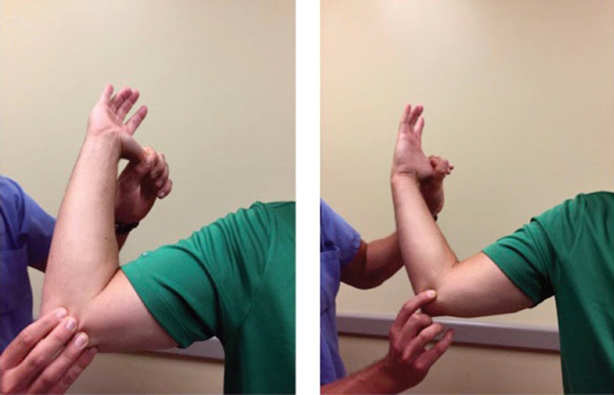 Musculoskeletal Examination | CHAPTER 3 | Orthopedic Nursing