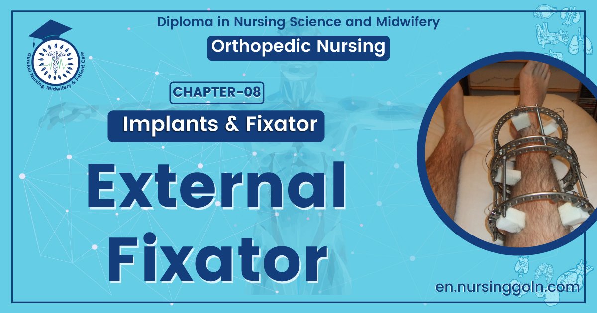 External Fixations | CHAPTER 8 | Orthopedic Nursing