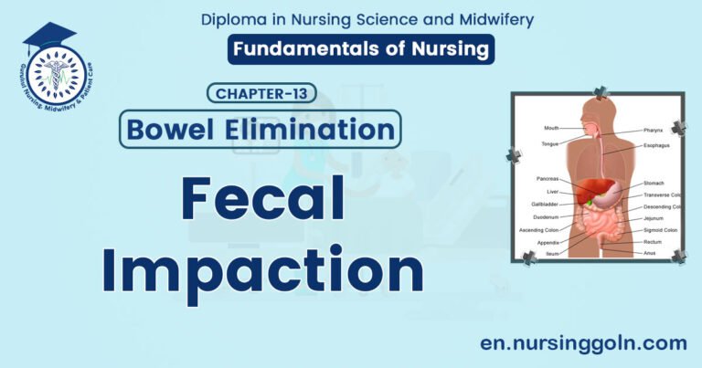 Fecal Impaction | CHAPTER 13 | Fundamentals of Nursing