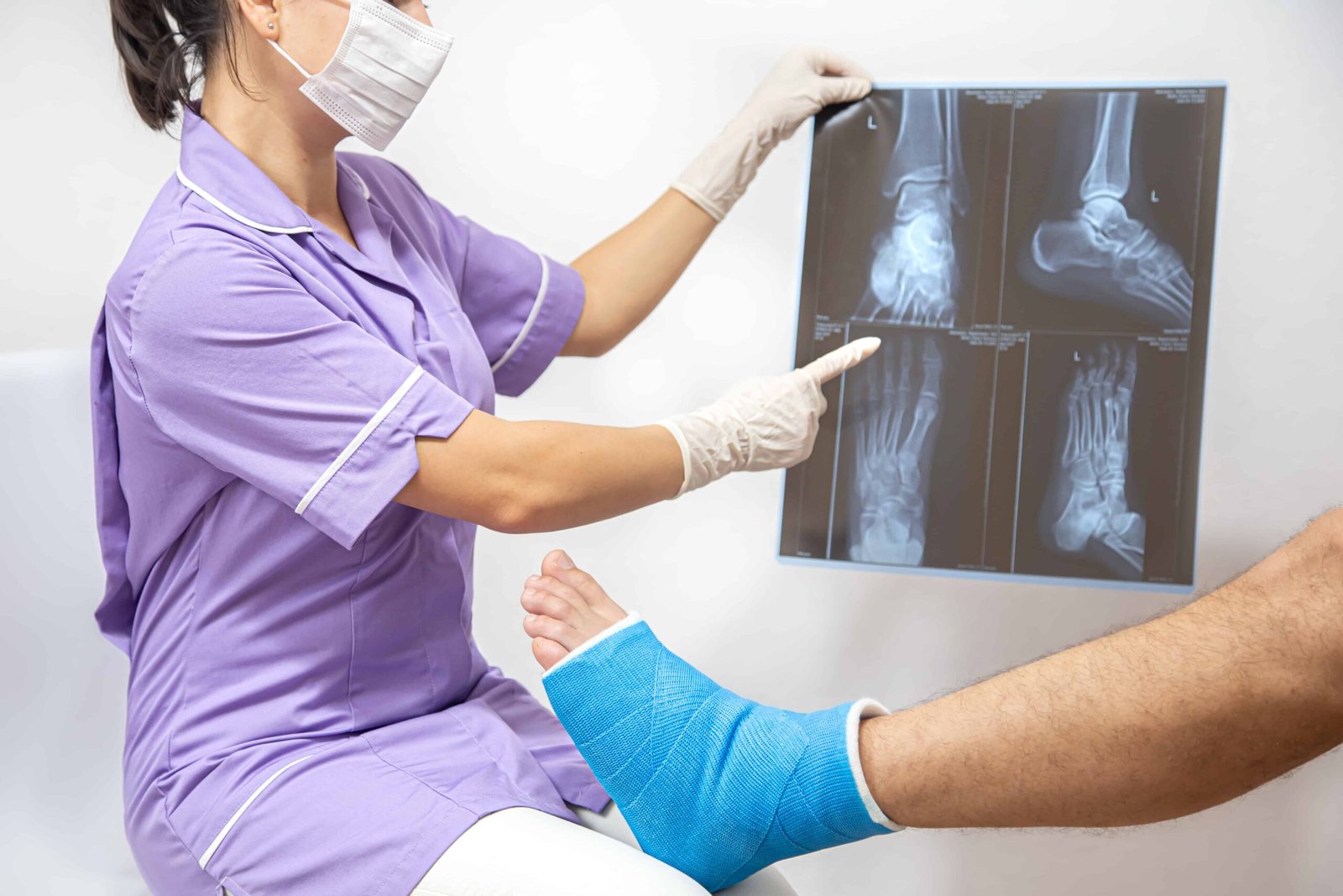 Definition of Fracture