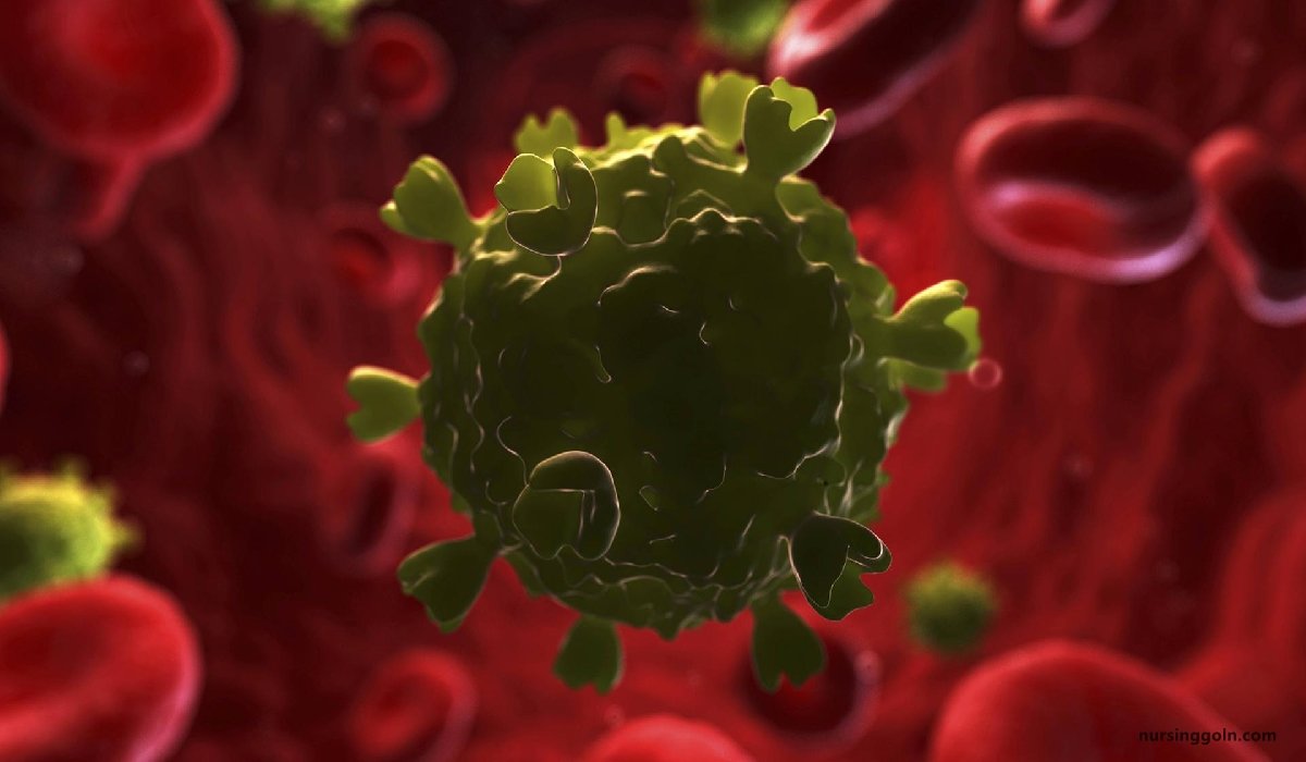 HIV or AIDS | CHAPTER-14 | Medical and Surgical Nursing