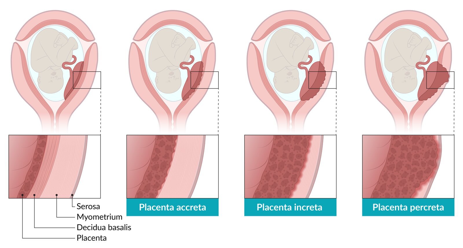 Definition of Haemorrhage | CHAPTER 21 | Fundamentals of Nursing