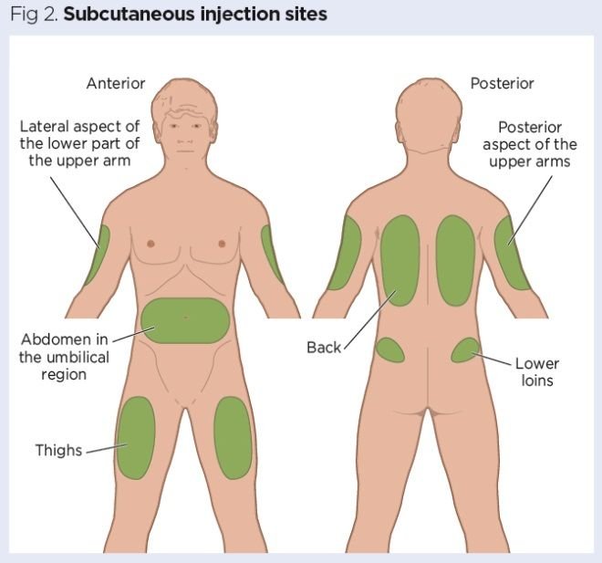 definition of intramuscular injection