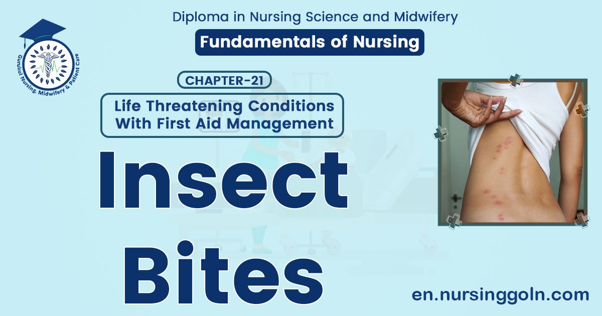 Insect bites | CHAPTER 21 | Fundamentals of Nursing