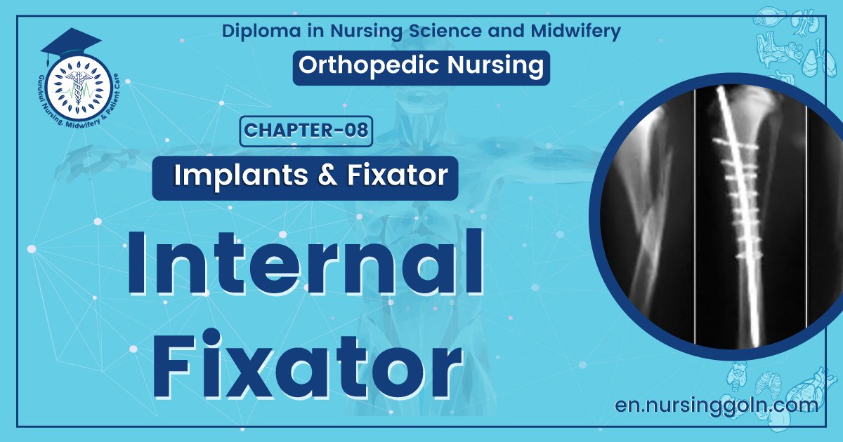 Internal Fixations | CHAPTER 8 | Orthopedic Nursing
