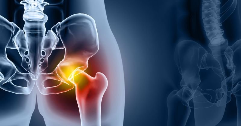 Metastatic Bone Disease | CHAPTER 16 | Orthopedic Nursing