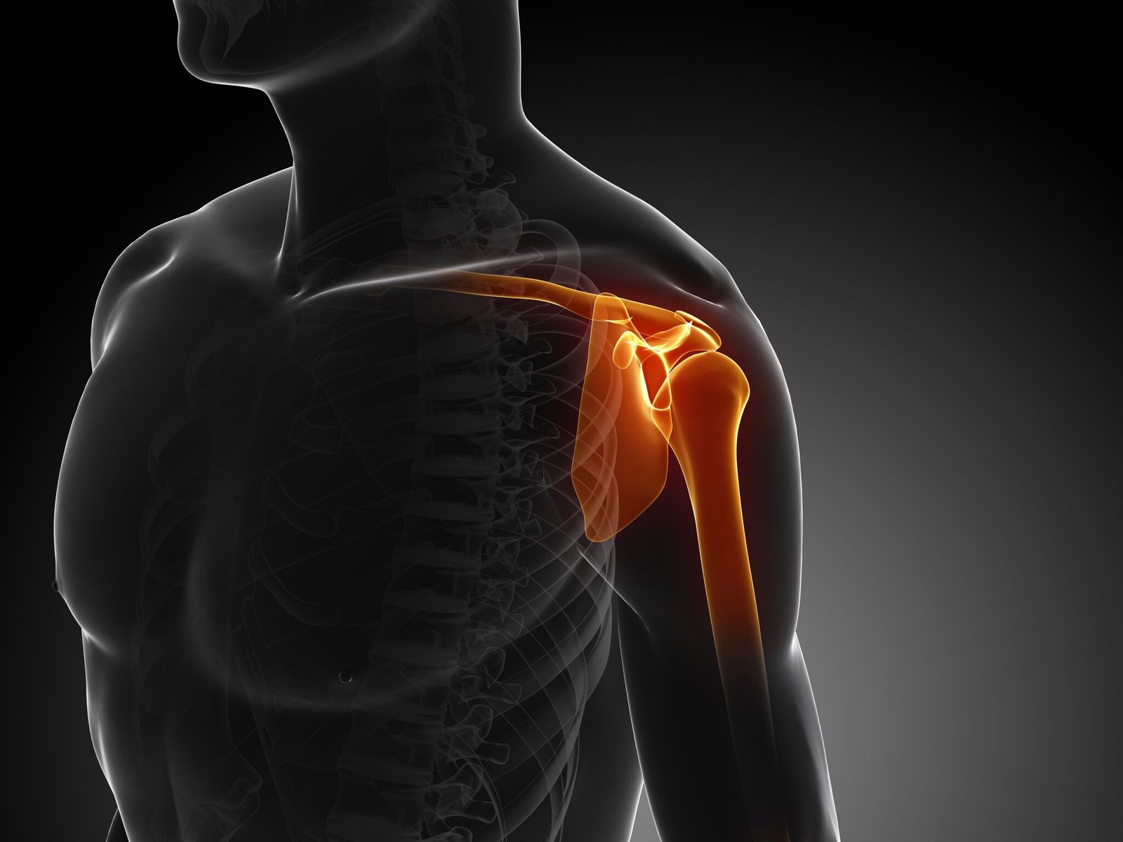 Musculoskeletal Injuries | CHAPTER 5 | Orthopedic Nursing