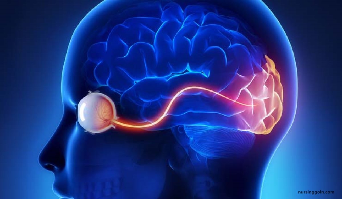 Concept of Neuritis | CHAPTER-14 | Medical and Surgical Nursing