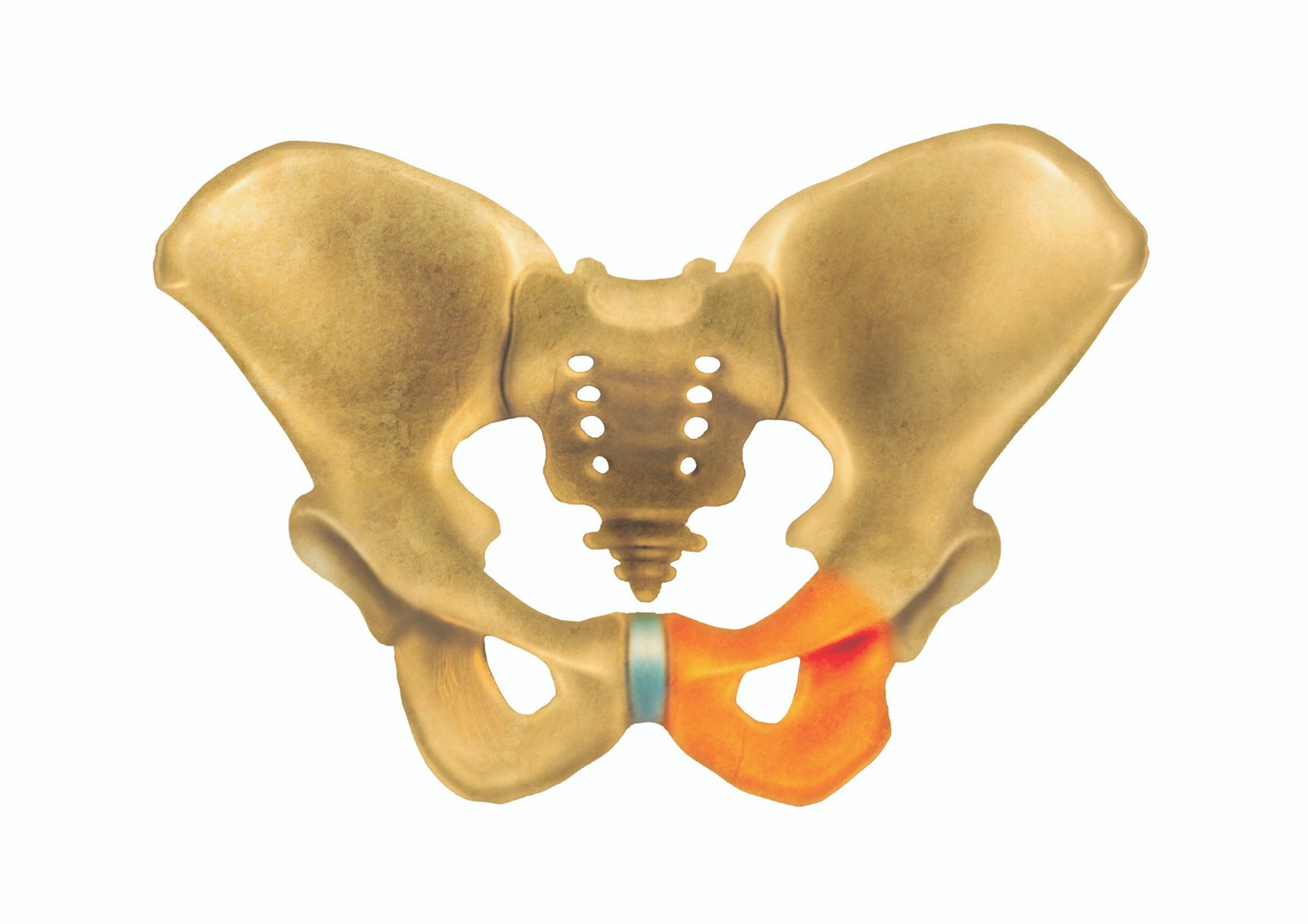 Pelvic fracture | CHAPTER 5 | Orthopedic Nursing