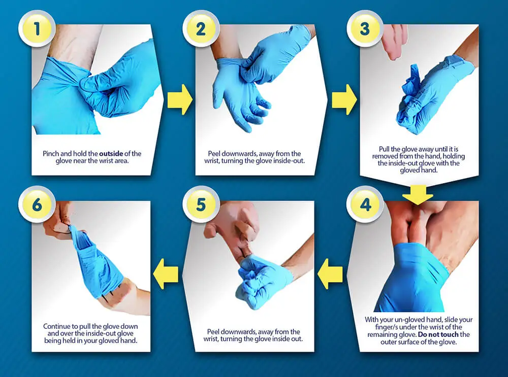 Procedure of Removing Surgical Gloving