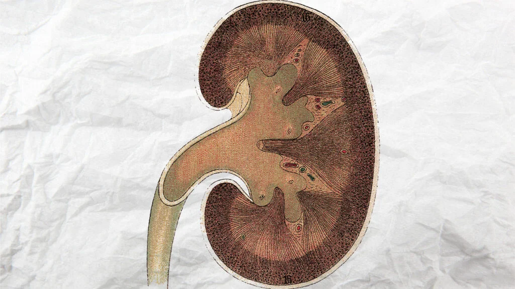 Renal Failure | Chapter 7 | Medical And Surgical Nursing