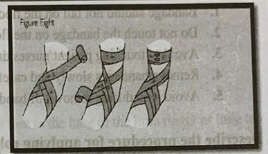 ROLLER BANDAGE | CHAPTER 22 | Fundamentals of Nursing