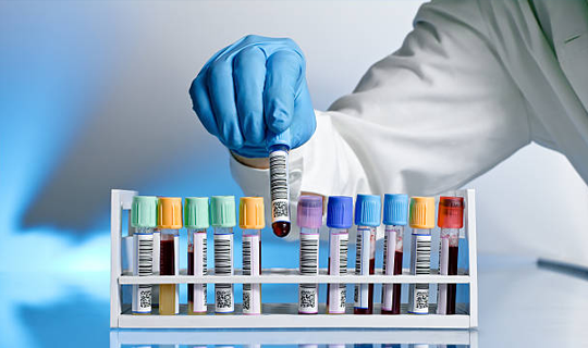 total serum protein test