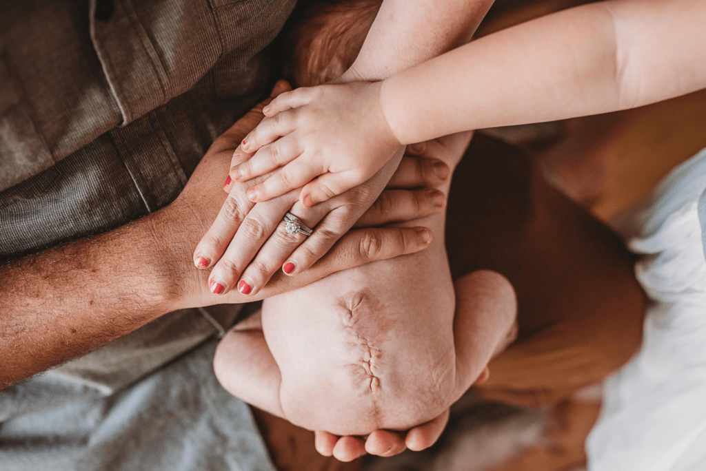 Spina Bifida | CHAPTER 19 | Orthopedic Nursing