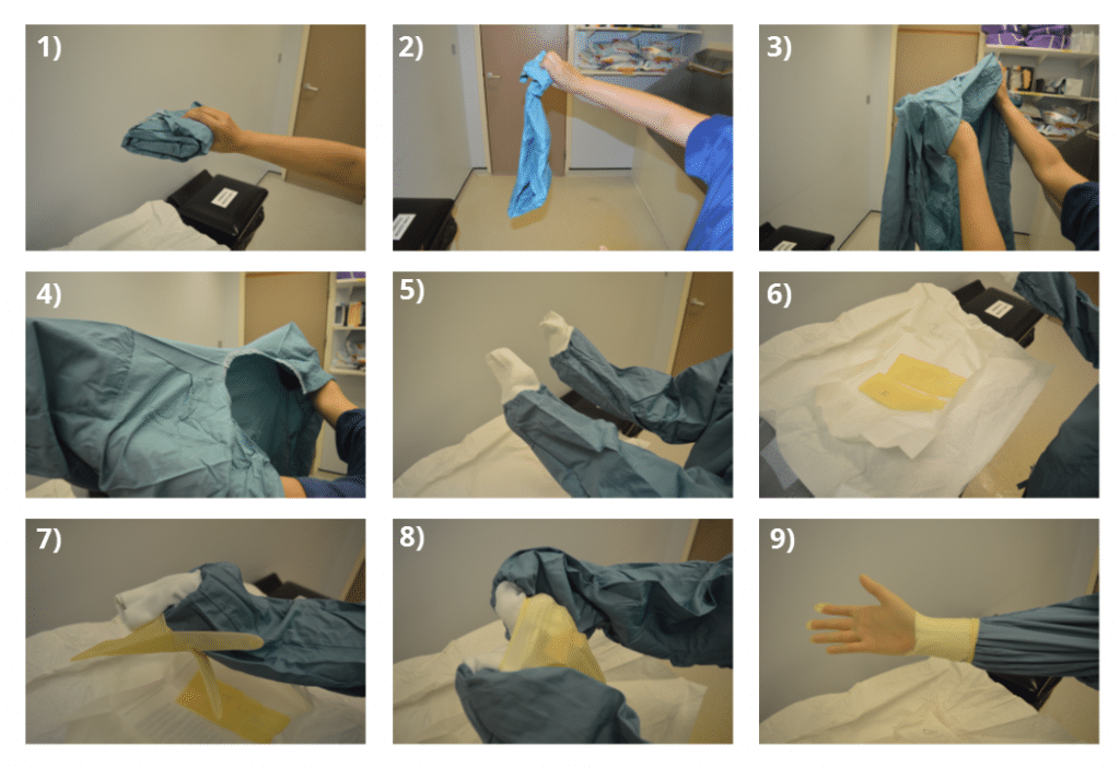 Steps of Surgical Gloving.