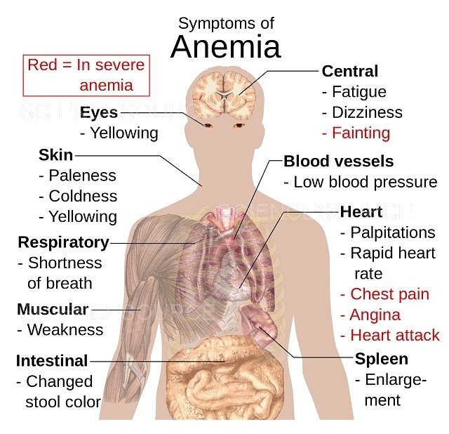 Concept of Anemia | CHAPTER-10 | Medical and Surgical Nursing
