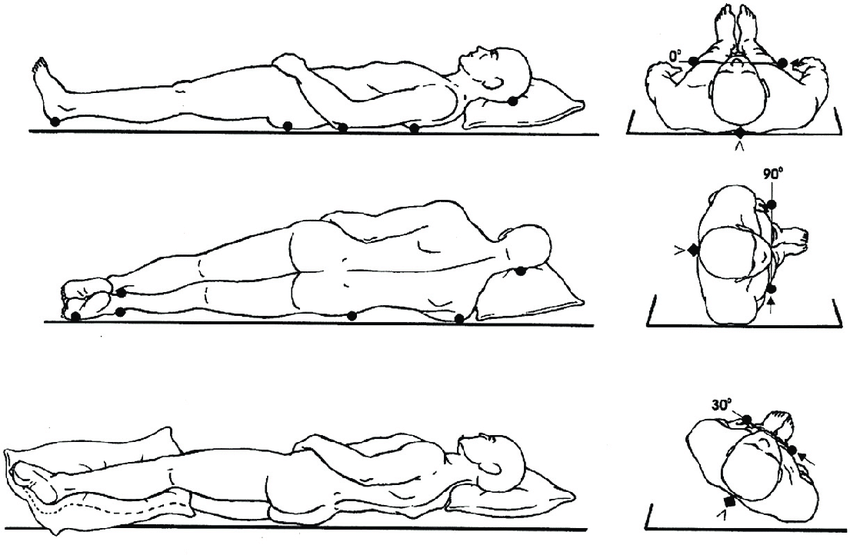 Definition of Immobility | CHAPTER 4 | Orthopedic Nursing