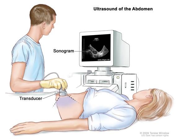 ultrasonic and ultra sonogram