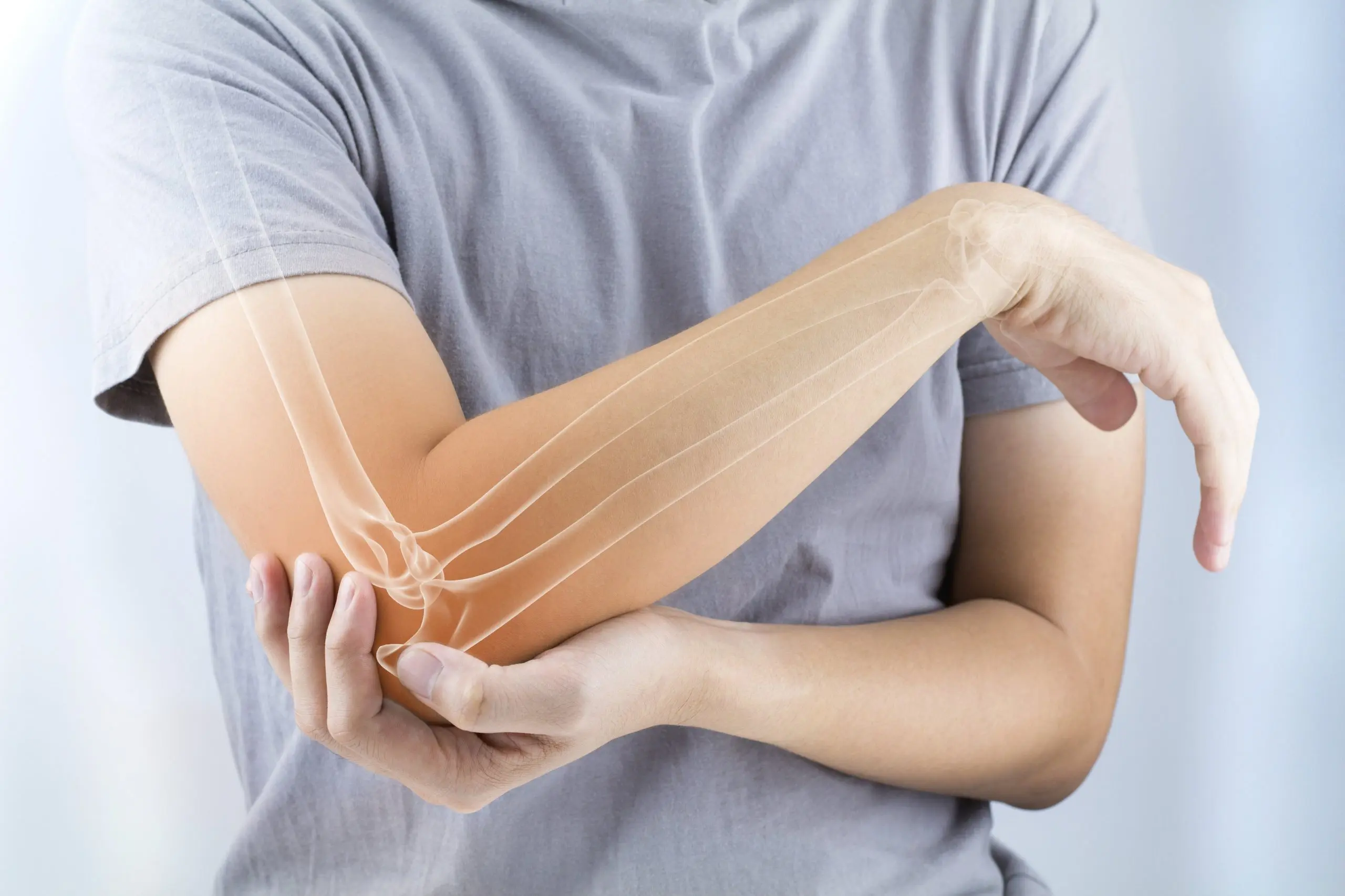 Definition of Dislocation | CHAPTER 21 | Fundamentals of Nursing 