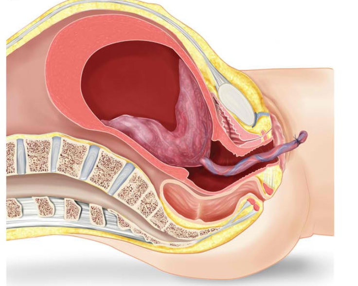 Third Stage Of Labor | Chapter 13 | Midwifery For Diploma In Nursing