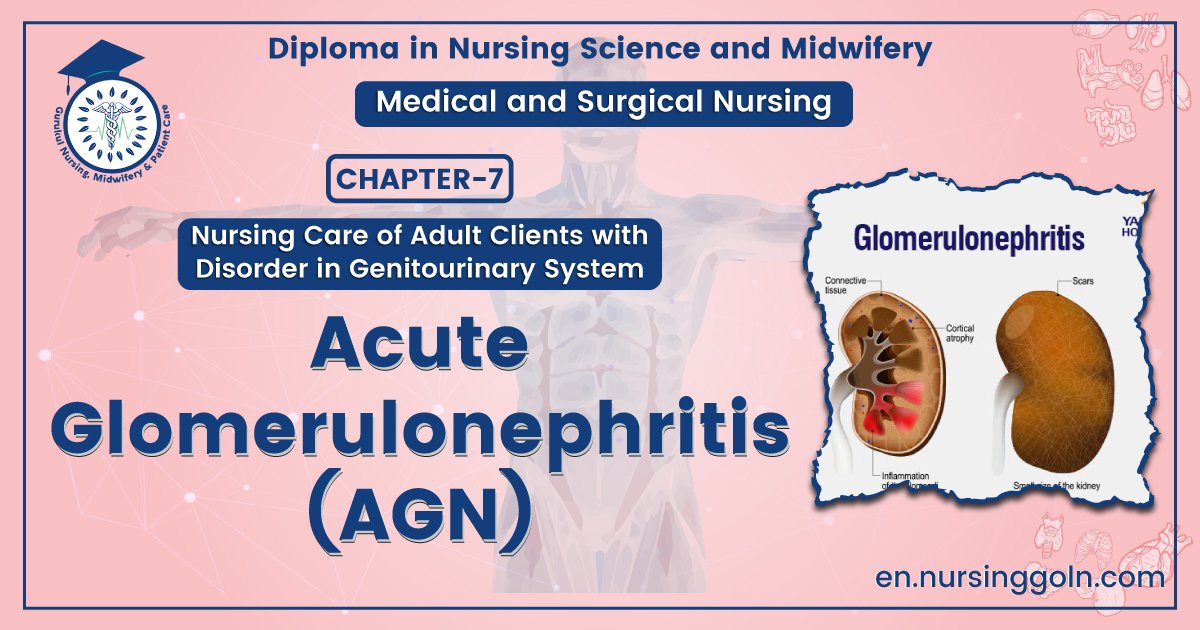 Acute Glomerulonephritis (AGN) | Chapter 7 | Medical And Surgical Nursing
