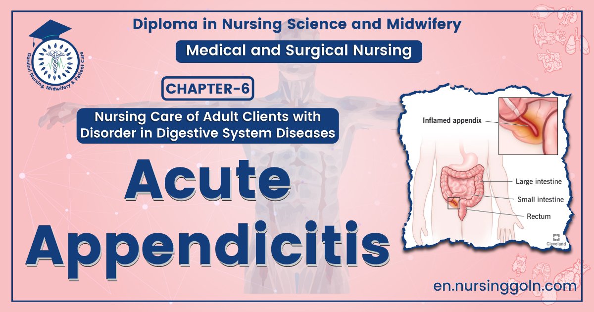 Acute appendicitis | CHAPTER-6 | Medical and Surgical Nursing