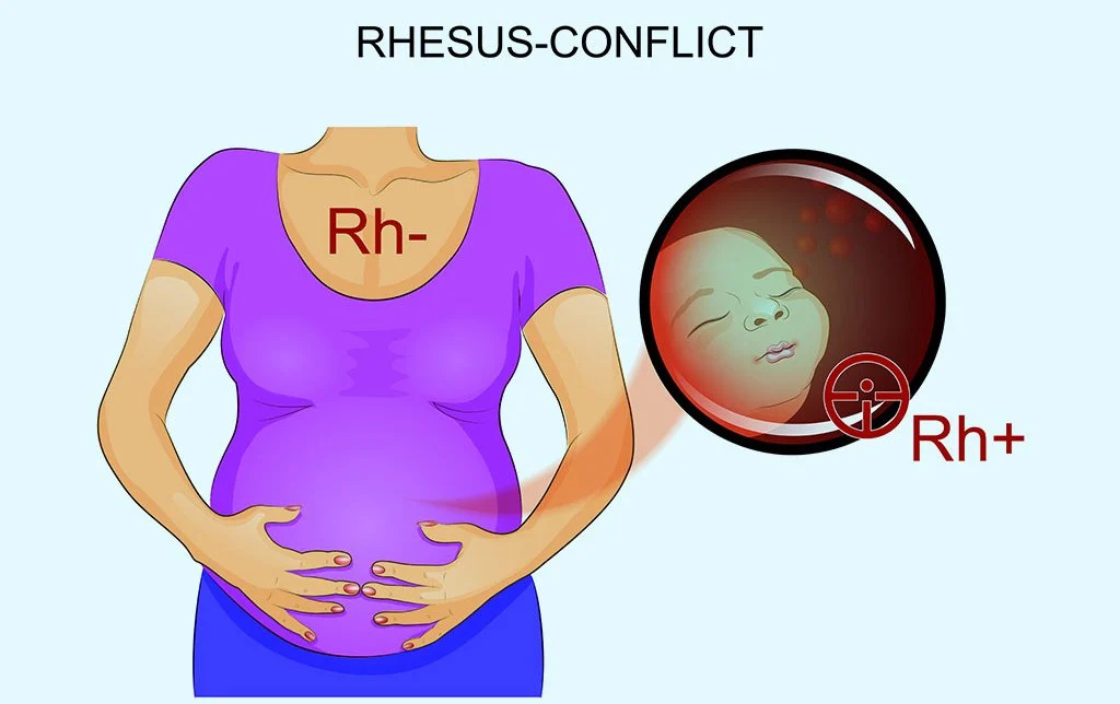 Complication that might occur in Rh negative female | CHAPTER 5 | Anatomy and Physiology