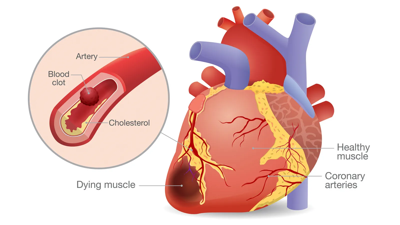 Coronary circulation | CHAPTER 5 | Anatomy and Physiology