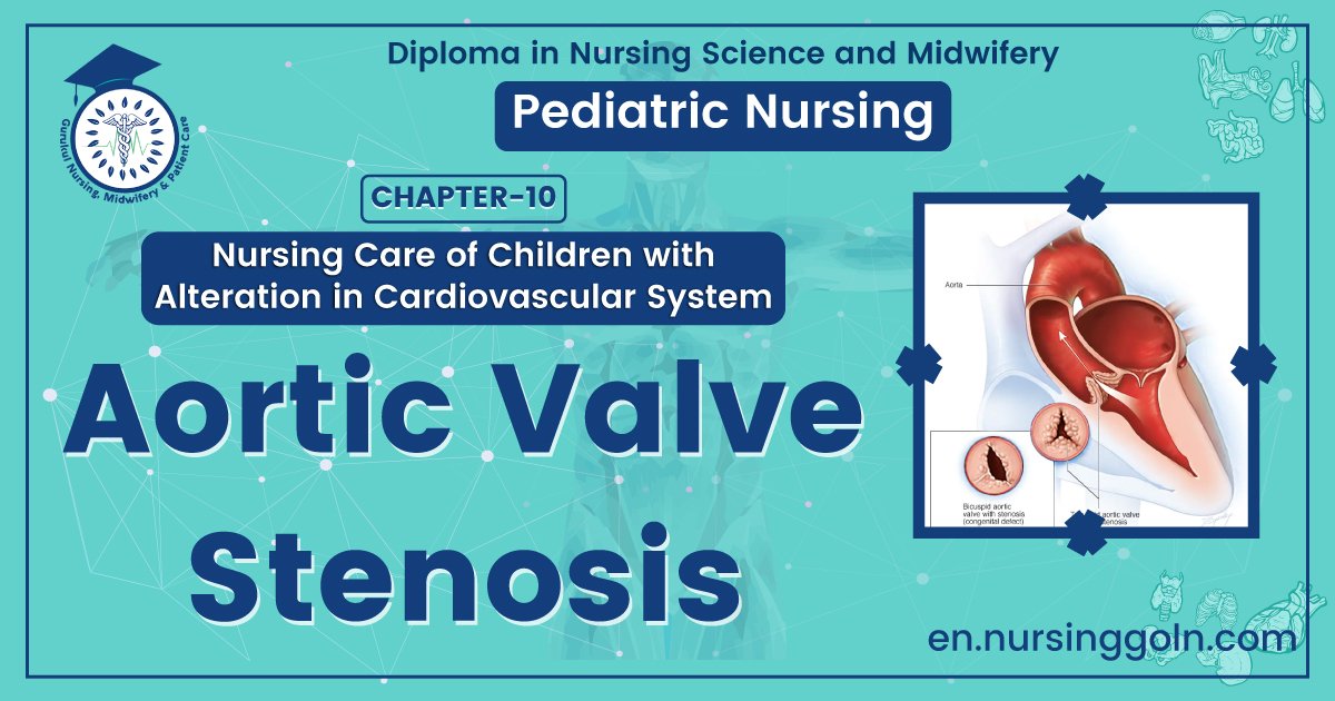 Aortic valve stenosis | CHAPTER 10 | Pediatric Nursing