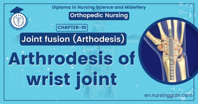 Arthrodesis of wrist joint | CHAPTER 10 | Orthopedic Nursing