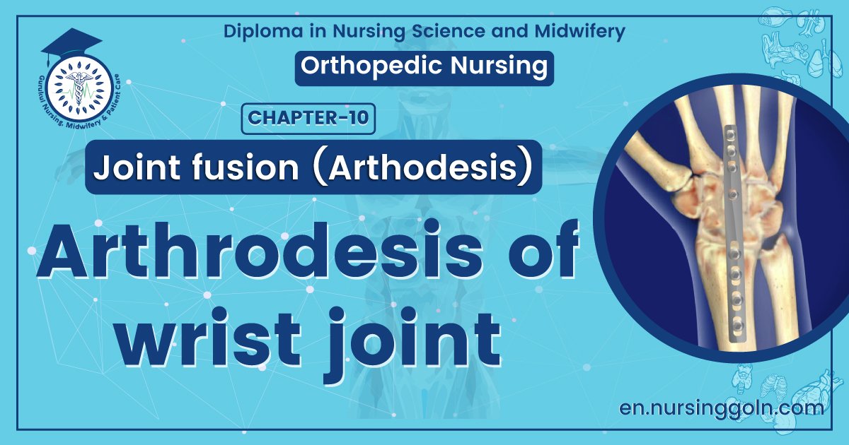 Arthrodesis of wrist joint | CHAPTER 10 | Orthopedic Nursing