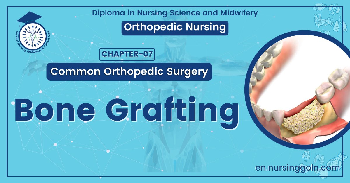 Bone Grafting | CHAPTER 7 | Orthopedic Nursing