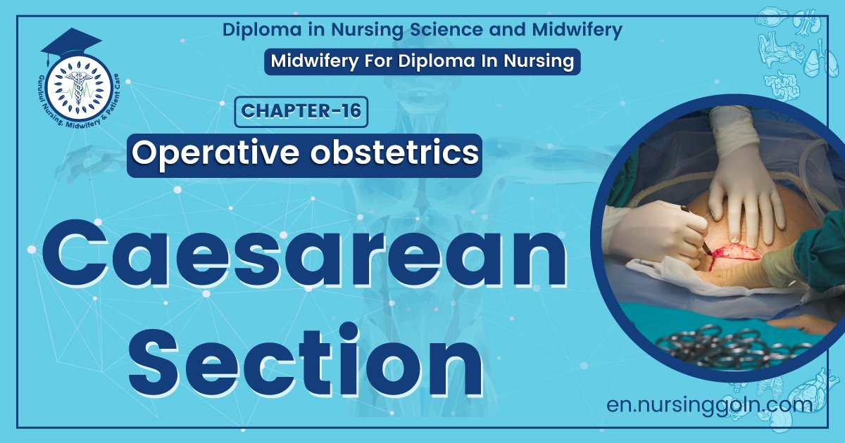 Caesarean section | Chapter 16 | Midwifery For Diploma In Nursing