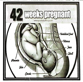 Post Term Labor | Chapter 17 | Midwifery For Diploma In Nursing