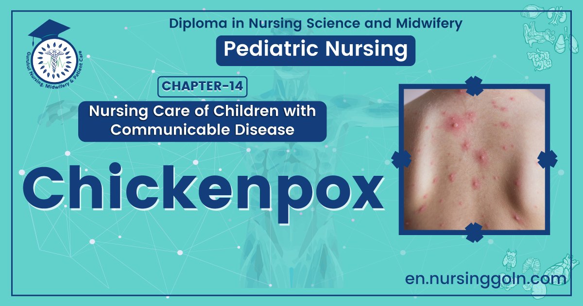 Concept about Chickenpox | CHAPTER 14 | Pediatric Nursing