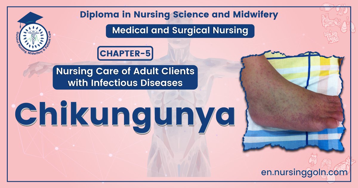 Definition of Chikungunya | Chapter 5 | Medical And Surgical Nursing