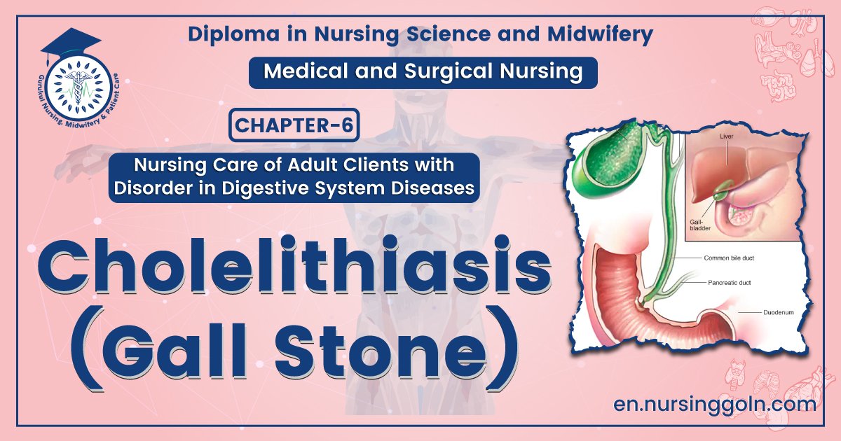 Definition of Cholelithiasis | CHAPTER-6 | Medical and Surgical Nursing