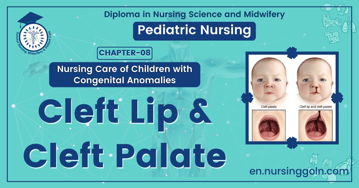 Cleft lip & cleft palate
