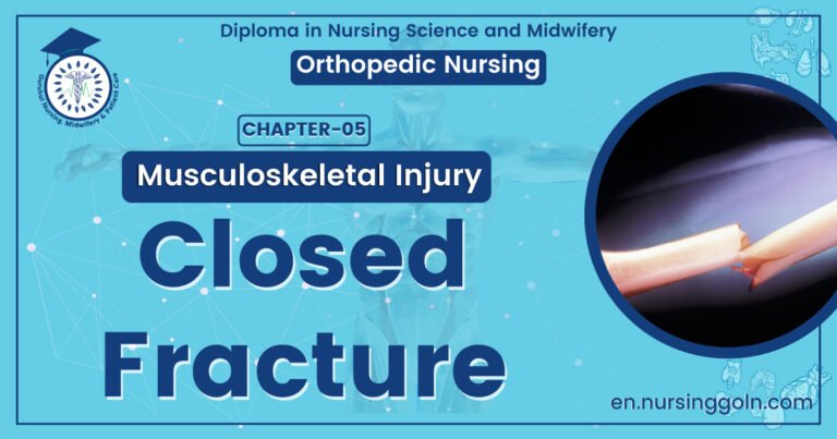 Closed Fracture | CHAPTER 5 | Orthopedic Nursing