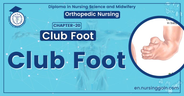 Concept About Club Foot | CHAPTER 20 | Orthopedic Nursing