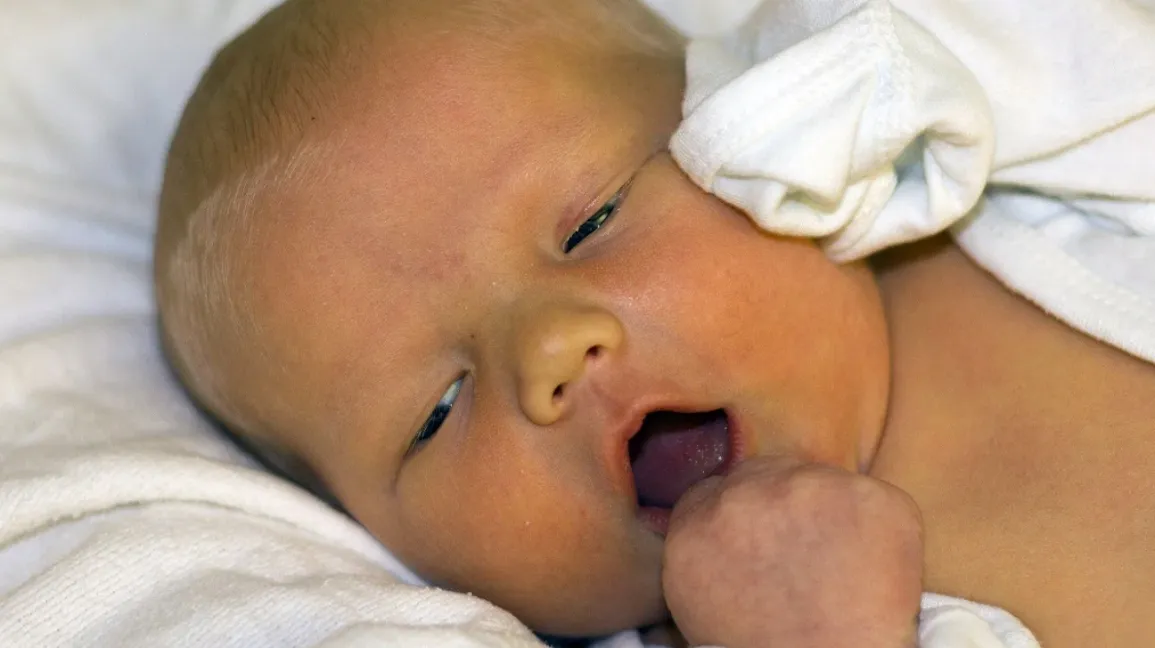 Common health problems of newborn 