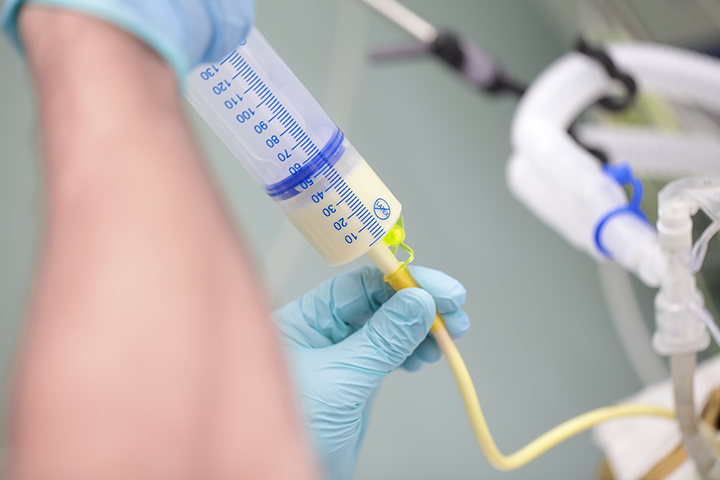 Concept of Nasogastric Tube Feeding