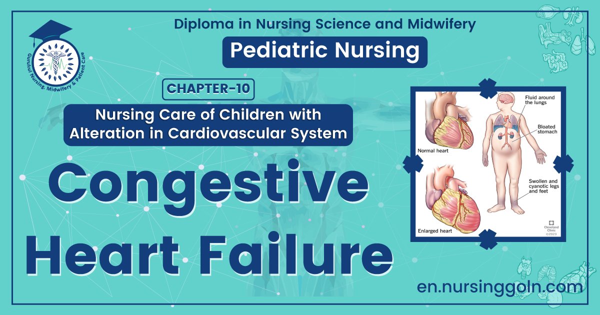 Congestive Heart Failure | CHAPTER 10 | Pediatric Nursing