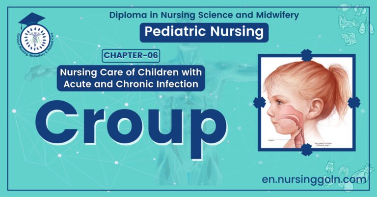 Definition of Croup | CHAPTER 6 | Pediatric Nursing