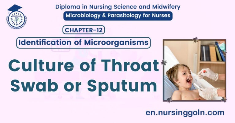 Culture of Throat Swab or Sputum