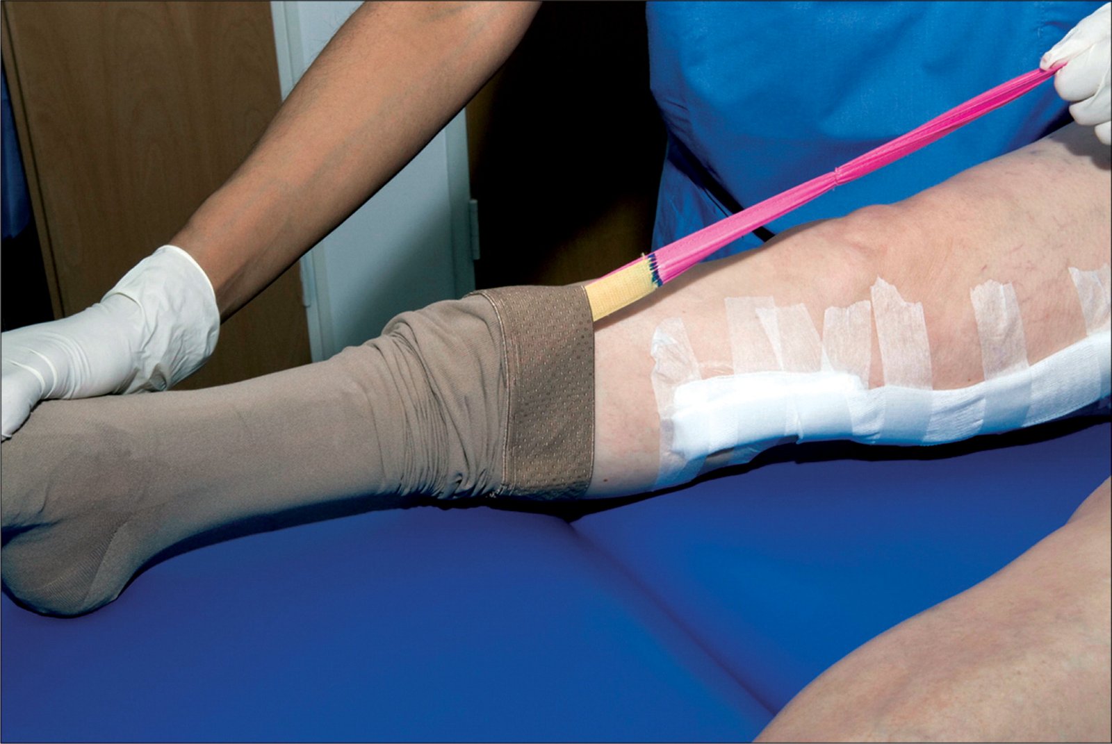 Deep Vein Thrombosis | CHAPTER 22 | Orthopedic Nursing
