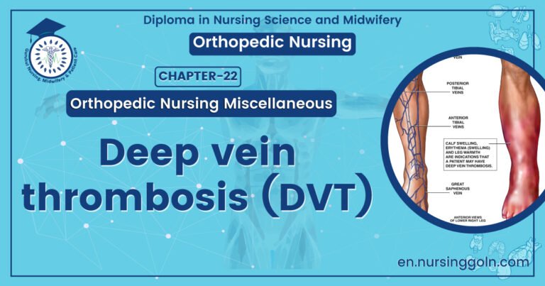 Deep Vein Thrombosis | CHAPTER 22 | Orthopedic Nursing