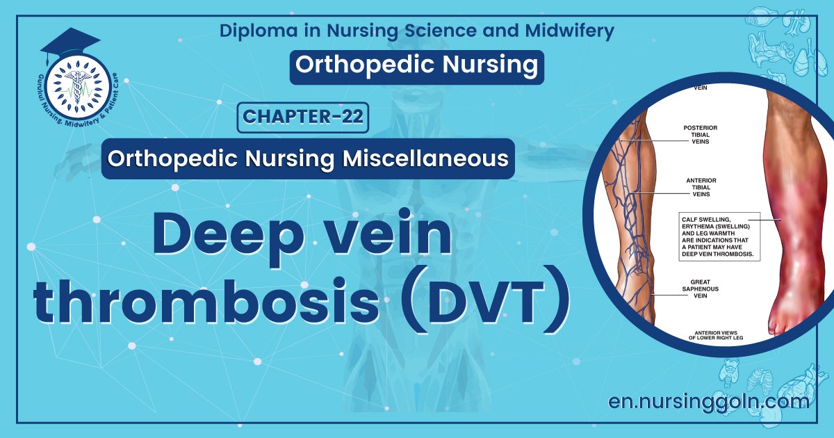 Deep Vein Thrombosis | CHAPTER 22 | Orthopedic Nursing