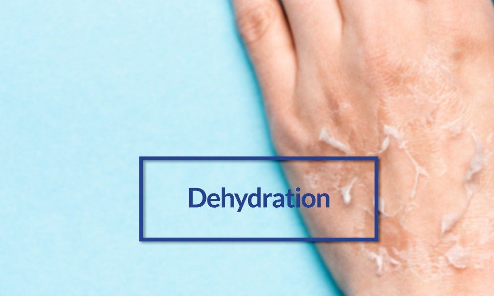 concept of dehydration