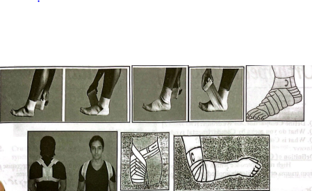 Different site of Figure of 8 bandage